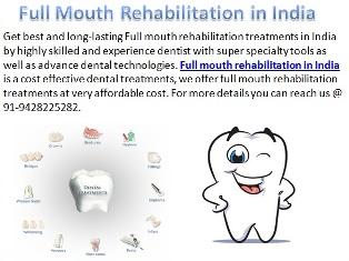 Offer Cost Effective Treatments of Full Mouth Rehabilitation in 