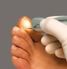 Necesitas un servicio de pedicure a 25