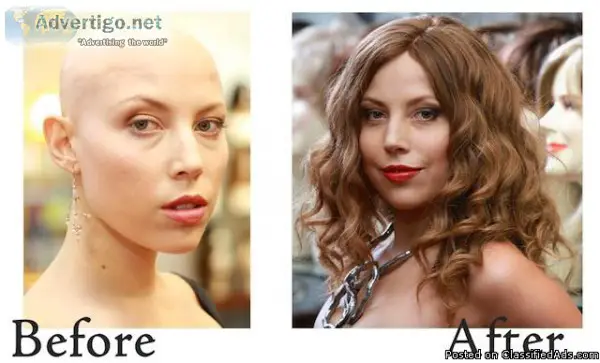 Alopecia  Eva and Co. Wigs