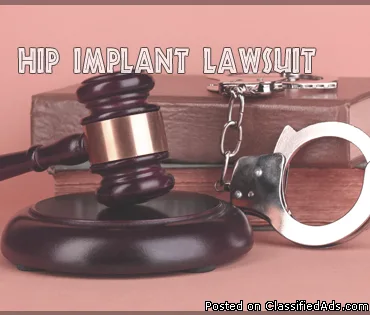 Hip Implant Lawsuit