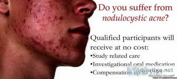 DO YOU SUFFER FROM SEVERE ACNE