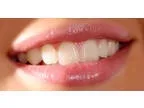 Dental Examination  Check-up incl. X- rays (if required)