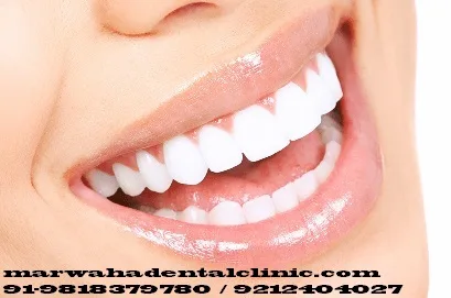 Best dentist in gurgaon for perfect care