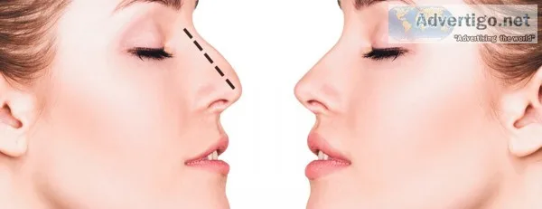 Rhinoplasty dubai book your appointment