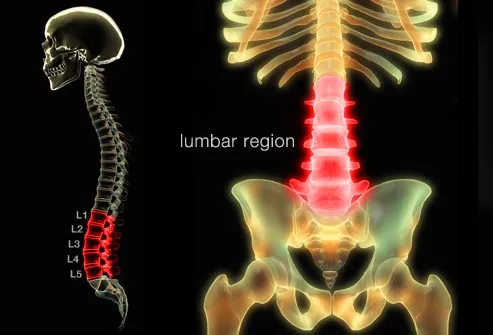 How to get rid of lower back pain