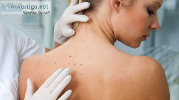 Best dermatologist in chandigarh