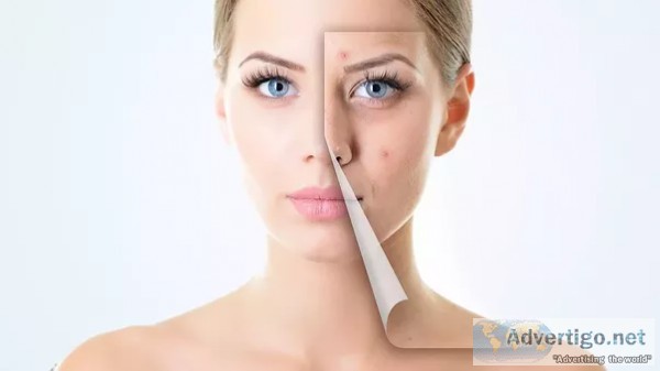 The best recommendation for skin special