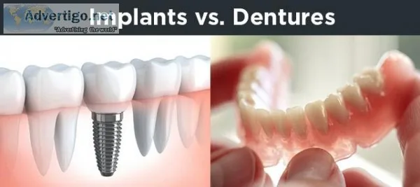 Best Implant Dentist in Delhi for best Dental Treatment