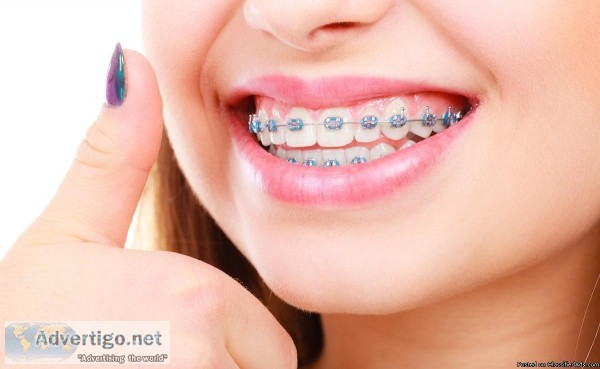 Invisalign Orthodontic Treatment - Wainright and Wassel DDS