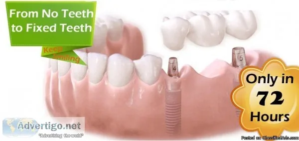 Best Dental Clinic in Vasant Vihar