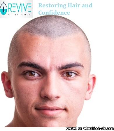 Top Hair Transplant in UK - Revive Hair and Skin Clinic