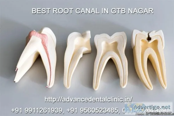 Best Dental Clinic in North Delhi