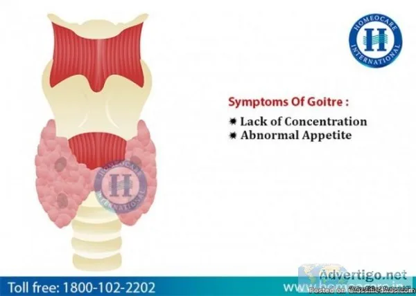 Best Homeopathy Treatment For Goiter  In Tambaram