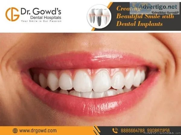 Best Dental Implants clinic  in Hyderabad and Secunderabad