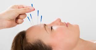 Acupuncture for menopause   Acupuncture hay fever lincoln