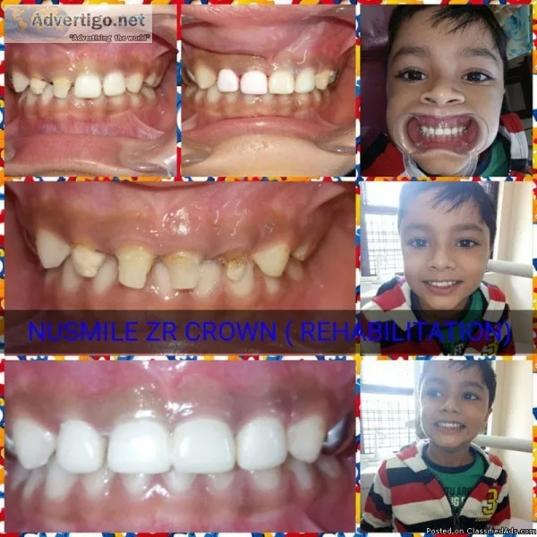 Best Dental Clinic near me