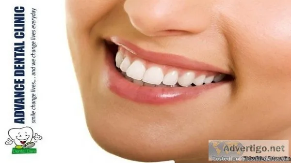 Smile Design Dental in GTB Nagar