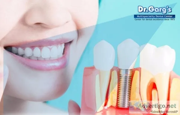 Gold Teeth Prices in India