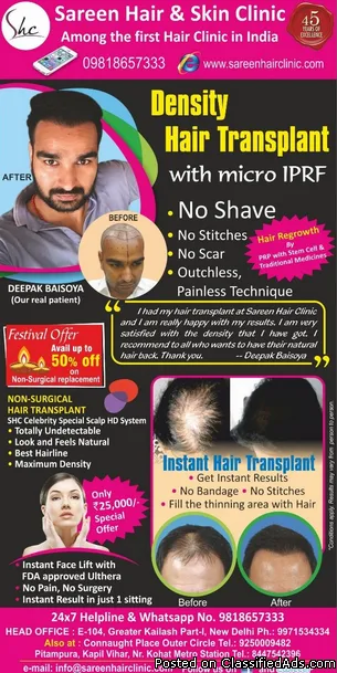 Diwali Offer At Sareen Hair Clinic Delhi