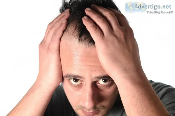 Hair Transplant Doctors in Kerala