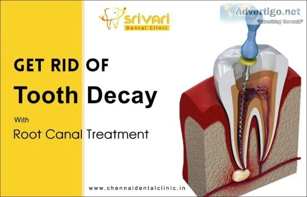 Never Give Up...You Can Save Your Teeth
