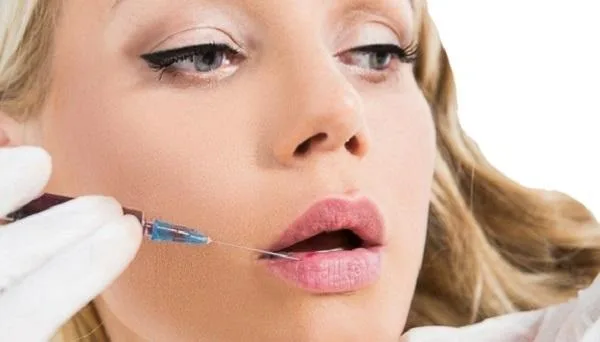 Lip Dermal Fillers  London  FA Aesthetics