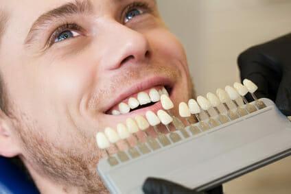 How to whiten your teeth in downey ca