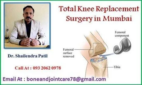Dr. Shailendra patil Mulund - Bone and joint care clinic