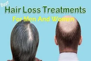 Best Hair Loss Treatment In UK - Revive Hair and Skin Clinic