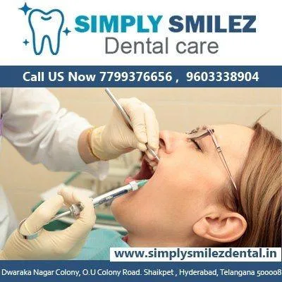 Best Dental Clinic in Hyderabad  simplysmilezdental.i n