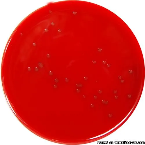 Brain Heart Infusion Agar