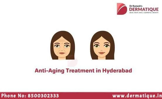 Anti-Aging Treatment Hyderabad