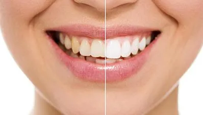 Best Dentist in Russell Ontario  Bright Dental Centre