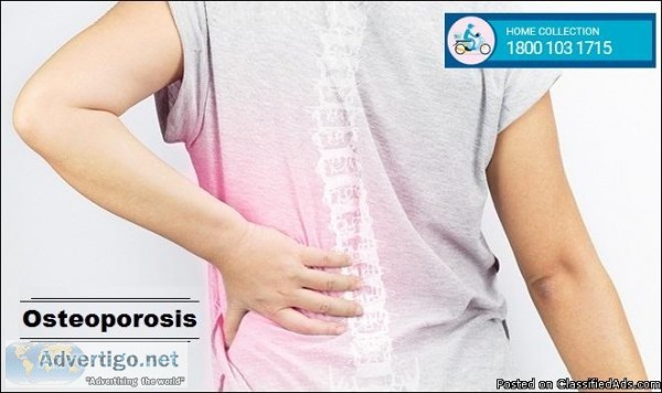 Book Osteoporosis Test in Mumbai