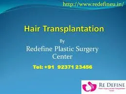 Hair Transplantation In Hyderabad  Hair Transplant Cost