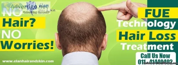 Cure Baldness in India- Cure Hair Loss in India