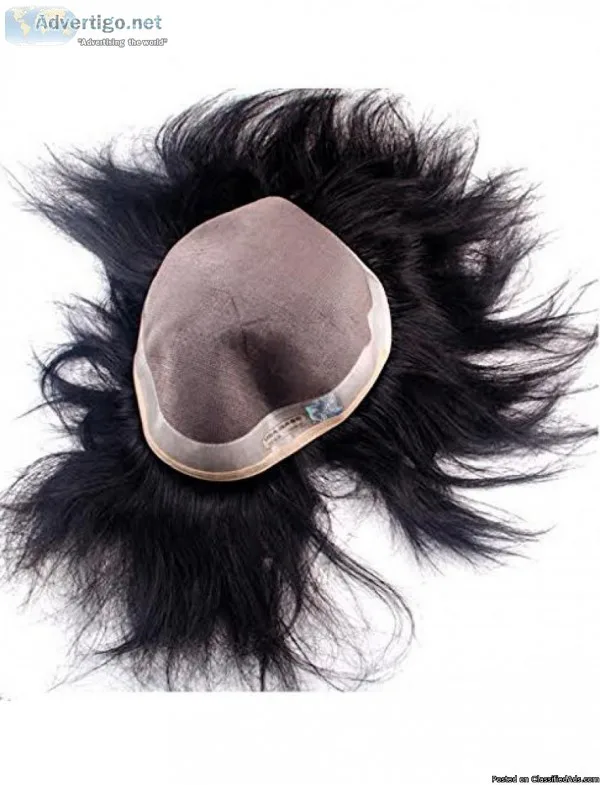 Hairwala.com - hair patch fixing in bapunagar