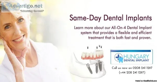 Get Immediate Dental Implants &ndash Same Day Teeth or Teeth in 