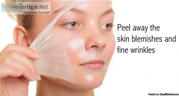 No More Acne scars - Berkowits Advance Chemical Peel Treatment