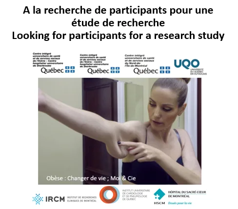 Looking for post-bariatric surgery participants  Participants re