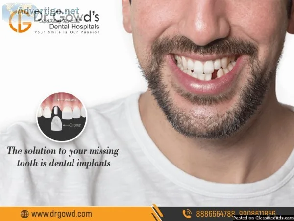 High-Quality Dental Implants in Hyderabad and Secunderabad