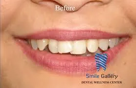 Dental Clinic near me