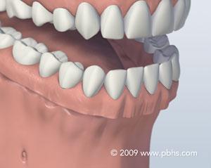 Find Expert Dentists in Columbia SC  Sunset Periodontics