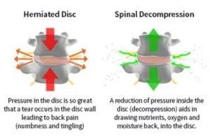 Best Chronic Pain Centre Calgary at YYC Sport and Spine