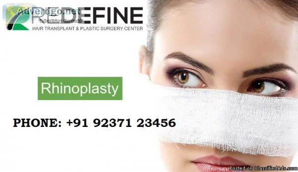 Hair Transplant in Hyderabad  Hair Transplant Cost