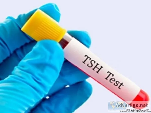 Need to Book TSH Test Learn More View Cost Book Online Get Resul