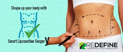 Liposuction In Hyderabad  Liposuction Surgery Cost
