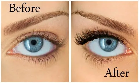 Hair loss treatment Toronto  Facial  Toronto