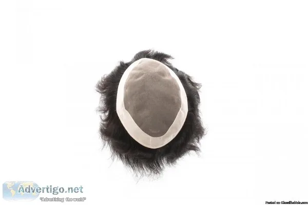 Hairwala.com - hair patch treatment in sabarmati