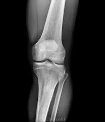 Best Orthopedic Treatment in Delhi  OrthopedicDelhi